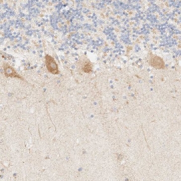 Anti-MYO10 antibody produced in rabbit，100UL，HPA024223-100UL，Sigma