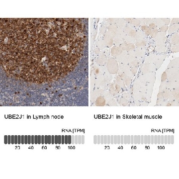 Anti-UBE2J1 antibody produced in rabbit，100UL，HPA003509-100UL，Sigma