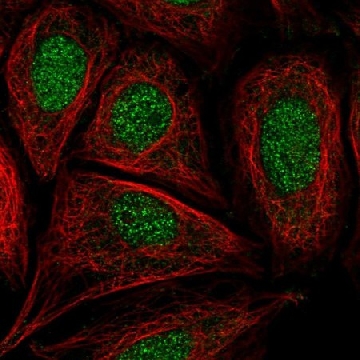 Anti-CCDC61 antibody produced in rabbit，100UL，HPA061548-100UL，Sigma