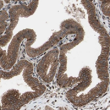 Anti-TNFRSF1A antibody produced in rabbit，100UL，HPA004102-100UL，Sigma