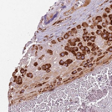 Anti-COLGALT1 antibody produced in rabbit，100UL，HPA047821-100UL，Sigma