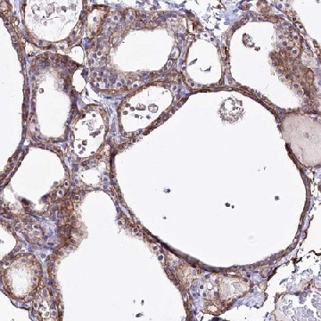 Anti-SLC39A10 antibody produced in rabbit，100UL，HPA036512-100UL，Sigma