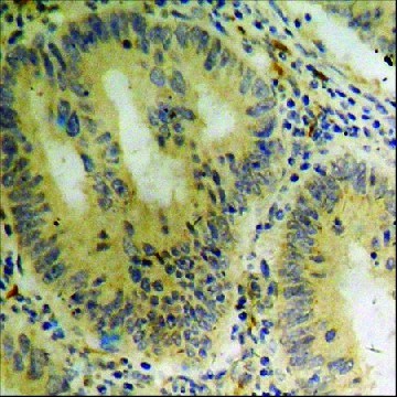 Anti-phospho-ASK1 (pSer⁹⁶⁶) antibody produced in rabbit，100UG，SAB4504337-100UG，Sigma