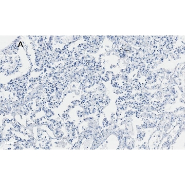 抗-整合素αV β6抗体，克隆EM05201，ZooMAb® 兔单克隆，4X25UL，ZRB1104-4X25UL，Sigma