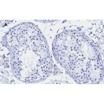 Anti-Androgen Receptor Antibody, clone 3K11 , ZooMAb® Rabbit Monoclonal，4X25UL，ZRB1150-4X25UL，Sigma
