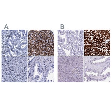 Anti-MYBPC3 antibody produced in rabbit，100UL，HPA040147-100UL，Sigma