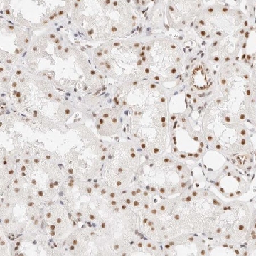 Anti-ZBED6 antibody produced in rabbit，100UL，HPA026439-100UL，Sigma