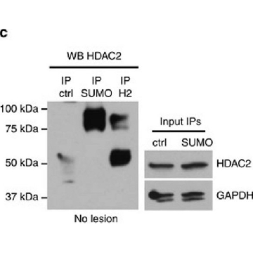 Anti-Histone Deacetylase 2 (HDAC2) antibody, Mouse monoclonal，25UL，H2663-25UL，Sigma