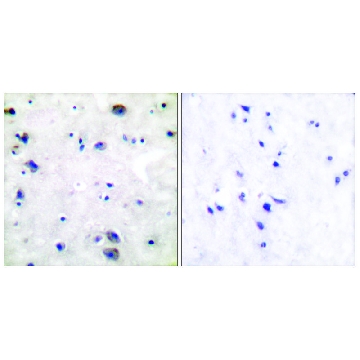 Anti-Opioid Receptor antibody produced in rabbit，100UG，SAB4502047-100UG，Sigma