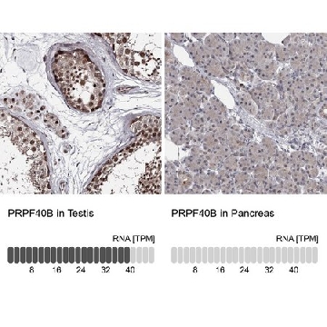 Anti-PRPF40B antibody produced in rabbit，100UL，HPA038426-100UL，Sigma