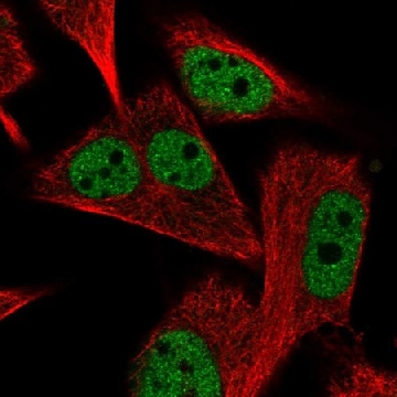 Anti-PGAM2 antibody produced in rabbit，100UL，HPA050314-100UL，Sigma