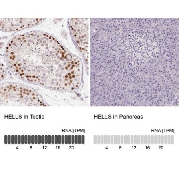 Anti-HELLS antibody produced in rabbit，100UL，HPA063242-100UL，Sigma