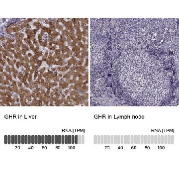 Anti-GHR antibody produced in rabbit，100UL，HPA045339-100UL，Sigma