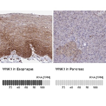 Anti-WNK1 antibody produced in rabbit，100UL，HPA059157-100UL，Sigma