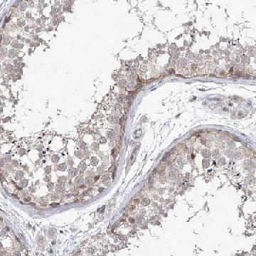Anti-PHF20L1 antibody produced in rabbit，100UL，HPA028417-100UL，Sigma