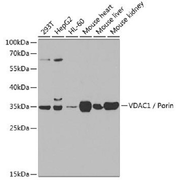 Anti-VDAC1/Porin antibody produced in rabbit，100UL，SAB5700655-100UL，Sigma