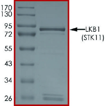 LKB1(STK11) Protein，50UG，SRP0690-50UG，Sigma