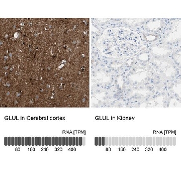 Anti-GLUL antibody produced in rabbit，100UL，HPA007316-100UL，Sigma