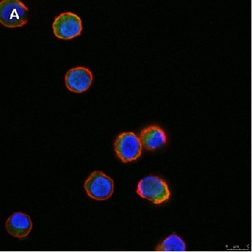 Anti-Tec Antibody, clone 19M23, ZooMAb® Rabbit Monoclonal，25UL，ZRB1344-25UL，Sigma