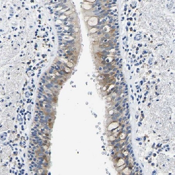 Anti-ZDHHC13 antibody produced in rabbit，100UL，HPA018791-100UL，Sigma