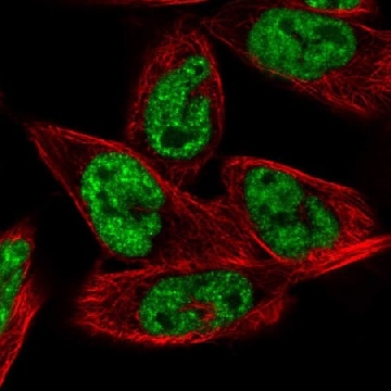 Anti-MORF4L1 antibody produced in rabbit，100UL，HPA062010-100UL，Sigma