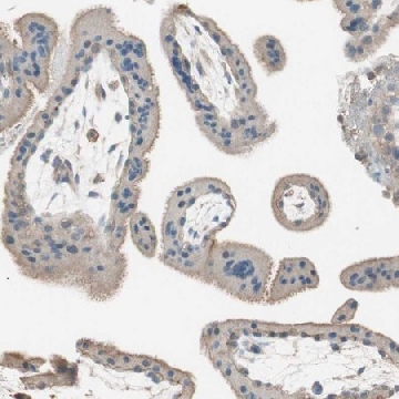 Anti-ITGBL1 antibody produced in rabbit，100UL，HPA005676-100UL，Sigma