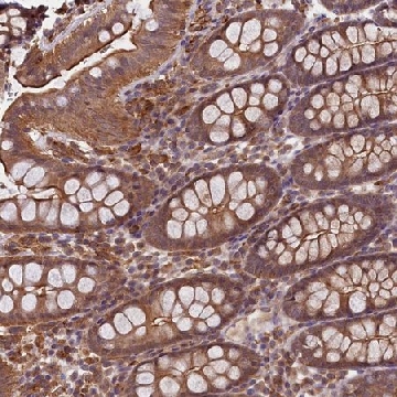 Anti-SKIDA1 antibody produced in rabbit，100UL，HPA039208-100UL，Sigma