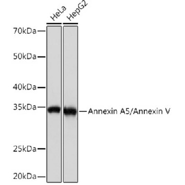 Anti-Annexin A5/Annexin V Antibody, clone 9A5M8, Rabbit Monoclonal，100UL，SAB5702648-100UL，Sigma