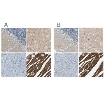 Anti-CACNA2D1 antibody produced in rabbit，100UL，HPA008213-100UL，Sigma