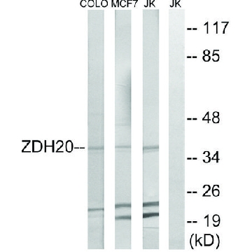 Anti-ZDHHC20 antibody produced in rabbit，100UG，SAB4501054-100UG，Sigma