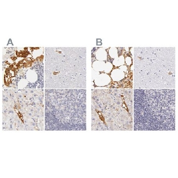 Anti-AHSG antibody produced in rabbit，100UL，HPA001525-100UL，Sigma