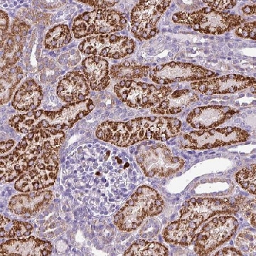 Anti-MGAT4B antibody produced in rabbit，100UL，HPA052134-100UL，Sigma