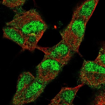 Anti-KDM4B antibody produced in rabbit，100UL，HPA062872-100UL，Sigma