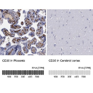 Anti-CD36 antibody produced in rabbit，100UL，HPA002018-100UL，Sigma