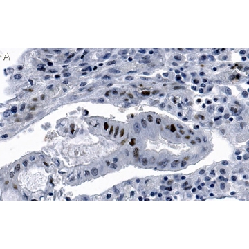 Anti-phospho-Chk2-Thr68 Antibody, clone 1B17 ZooMAb® Rabbit Monoclonal，25UL，ZRB1434-25UL，Sigma