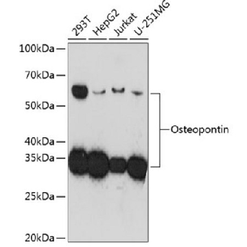 Anti-Osteopontin Antibody, clone 5E3A6, Rabbit Monoclonal，100UL，SAB5702115-100UL，Sigma