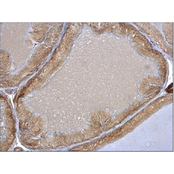 Anti-HSPA8 antibody produced in rabbit，100UL，SAB2701964-100UL，Sigma