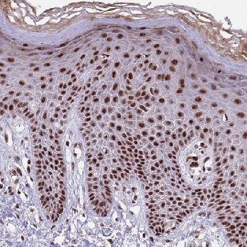 Anti-THOC2 antibody produced in rabbit，100UL，HPA047921-100UL，Sigma