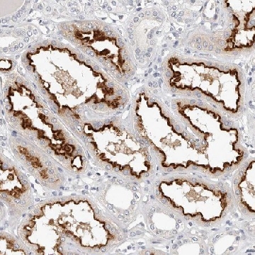 Anti-TMEM63B antibody produced in rabbit，100UL，HPA029249-100UL，Sigma