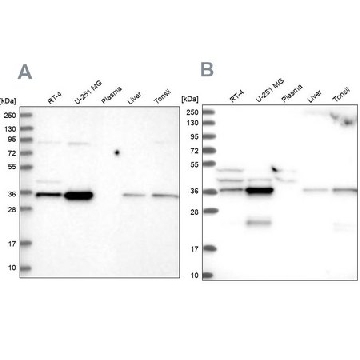 Anti-GPATCH11 antibody produced in rabbit，100UL，HPA038231-100UL，Sigma