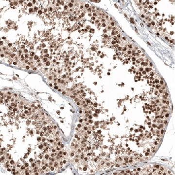 Anti-C11orf84 antibody produced in rabbit，100UL，HPA040128-100UL，Sigma