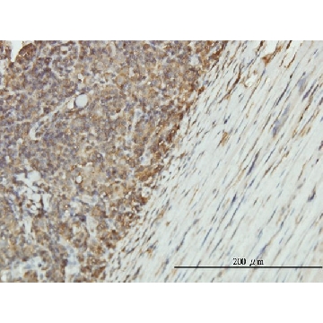 Monoclonal Anti-ENO1 antibody produced in mouse，100UG，WH0002023M1-100UG，Sigma