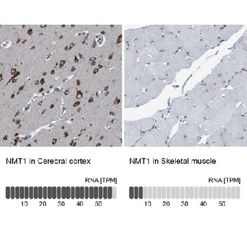 Anti-NMT1 antibody produced in rabbit，100UL，HPA022963-100UL，Sigma