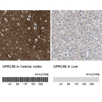 Anti-GPRC5B antibody produced in rabbit，100UL，HPA015247-100UL，Sigma