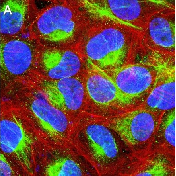 Anti-Calreticulin Antibody, clone 1F16 ZooMAb® Rabbit Monoclonal，25UL，ZRB1681-25UL，Sigma
