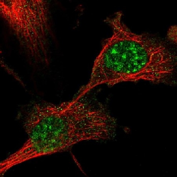Anti-DBNDD1 antibody produced in rabbit，100UL，HPA043018-100UL，Sigma