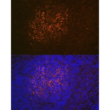 Anti-CR2/CD21 Antibody, clone 9F8A1, Rabbit Monoclonal，100UL，SAB5702045-100UL，Sigma