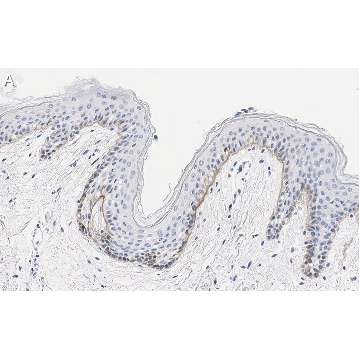 Anti-Laminin-5 γ2 Antibody, clone D4B5 ZooMAb® Mouse Monoclonal，25UL，ZMS1059-25UL，Sigma