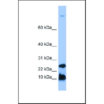 Anti-HAMP, (N-terminal) antibody produced in rabbit，100UL，SAB2104816-100UL，Sigma