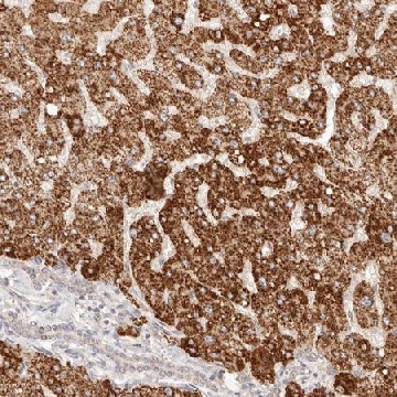 Anti-IL1R2 antibody produced in rabbit，100UL，HPA027597-100UL，Sigma